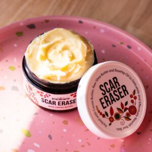 scar eraser cream